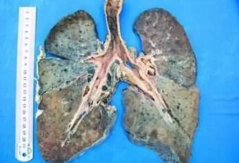 ���m�β��������ӟ��m������